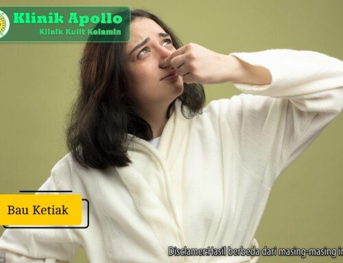Bau Ketiak: Penyebab dan Cara Menghilangkannya