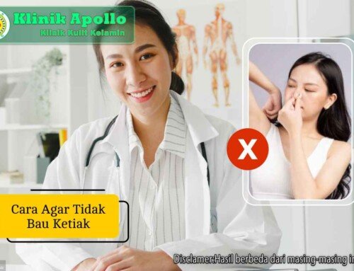 7 Cara Agar Tidak Bau Ketiak yang Mudah Dicoba