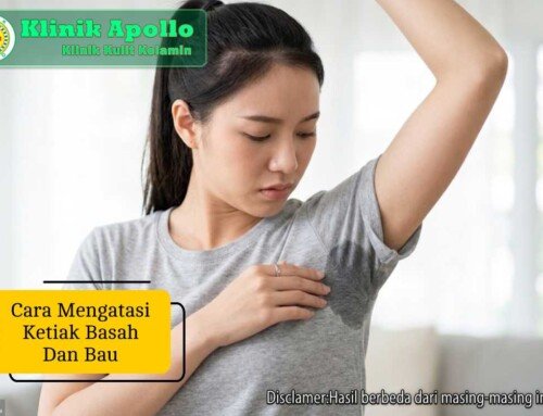 Panduan Praktis Cara Mengatasi Ketiak Basah dan Bau