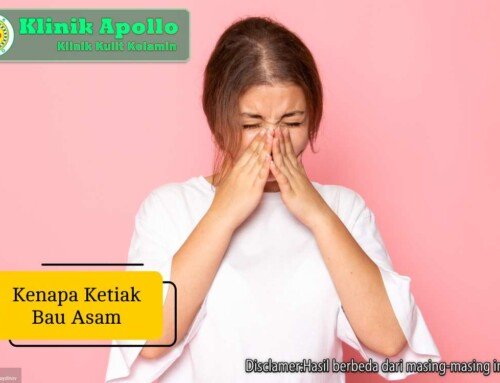 Kenapa Ketiak Bau Asam? Ini Penyebab dan Cara Mengatasinya