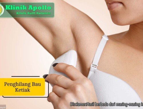 10 Rekomendasi Penghilang Bau Ketiak Terbaik dan Ampuh
