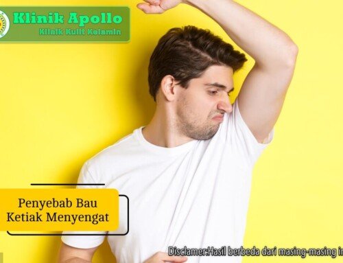 Penyebab Bau Ketiak Menyengat dan Cara Mengatasinya