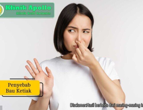 Penyebab Bau Ketiak: 10 Faktor dan Cara Mengatasinya
