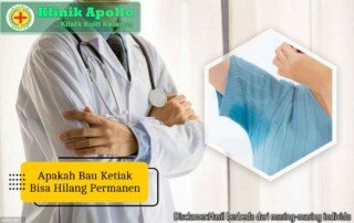 Ilustrasi Apakah Bau Ketiak Bisa Hilang Permanen.