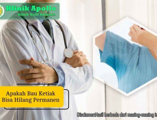 Apakah Bau Ketiak Bisa Hilang Permanen? Ini Faktanya