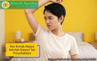 Ilustrasi Bau Ketiak Hanya Sebelah Kanan.