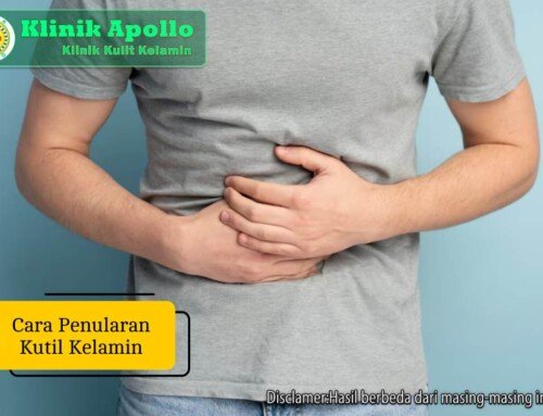 Cara Penularan Kutil Kelamin dan Cara Mengurangi Risikonya