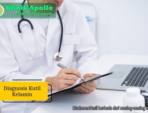 Diagnosis Kutil Kelamin: Pemeriksaan yang Dilakukan Dokter