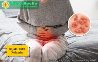 Ilustrasi Gejala Kutil Kelamin.
