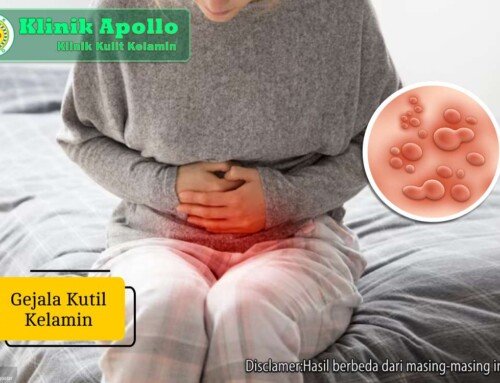 Gejala Kutil Kelamin: Kenali Ciri, Penyebab & Cara Atasinya