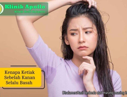 Kenapa Ketiak Sebelah Kanan Selalu Basah? Ini Penyebabnya