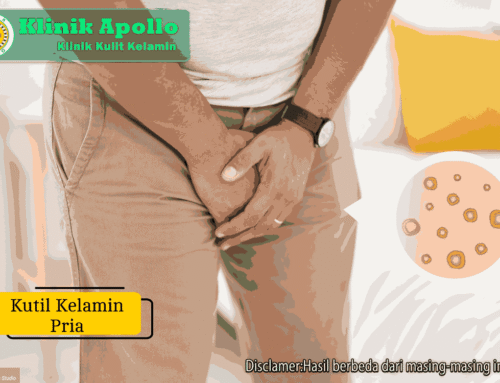 Kutil Kelamin pada Pria: Gejala, Penyebab, dan Penanganan