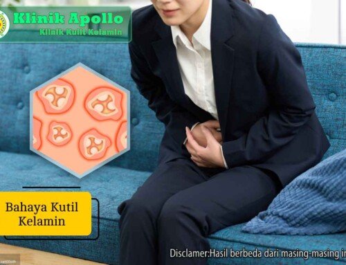Bahaya Kutil Kelamin Jika Tidak Ditangani