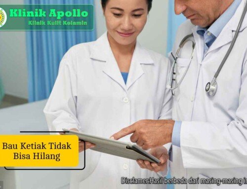 Kenapa Bau Ketiak Tidak Bisa Hilang? Ini Cara Mengatasinya
