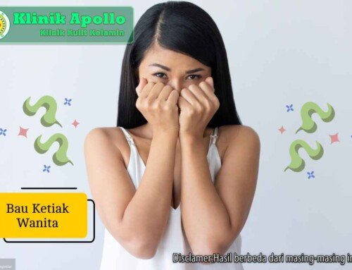 Penyebab Bau Ketiak Wanita dan Cara Mengatasinya