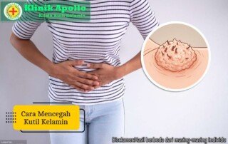 Ilustrasi Cara Mencegah Kutil Kelamin.