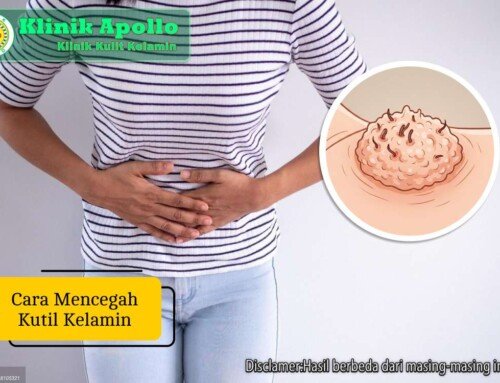 Cara Mencegah Kutil Kelamin dan Infeksi HPV