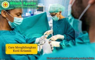 Ilustrasi Cara Menghilangkan Kutil Kelamin.