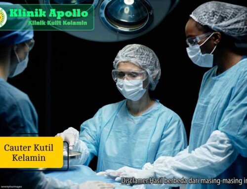 Cauter Kutil Kelamin: Prosedur dan Hal yang Perlu Diketahui