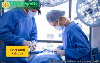 Ilustrasi Laser Kutil Kelamin.