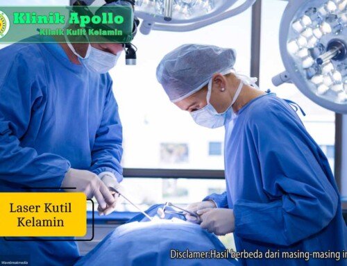 Laser Kutil Kelamin: Prosedur, Manfaat, dan Pemulihan