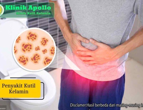 Penyakit Kutil Kelamin: Ciri, Penyebab, dan Pengobatannya