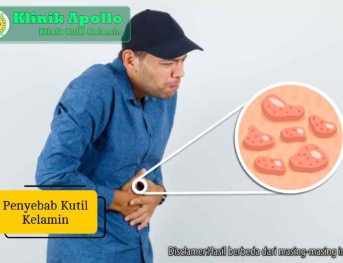Penyebab Kutil Kelamin dan Faktor Risiko Infeksi HPV