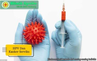 Ilustrasi HPV dan Kanker Serviks.