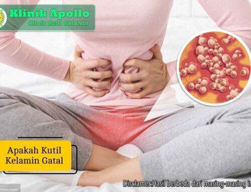 Apakah Kutil Kelamin Gatal? Ini Ciri-ciri Aslinya