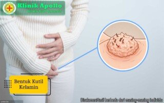 Ilustrasi Bentuk Kutil Kelamin.