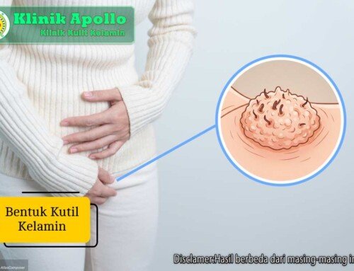 Bentuk Kutil Kelamin: Ciri dan Lokasi Kemunculannya