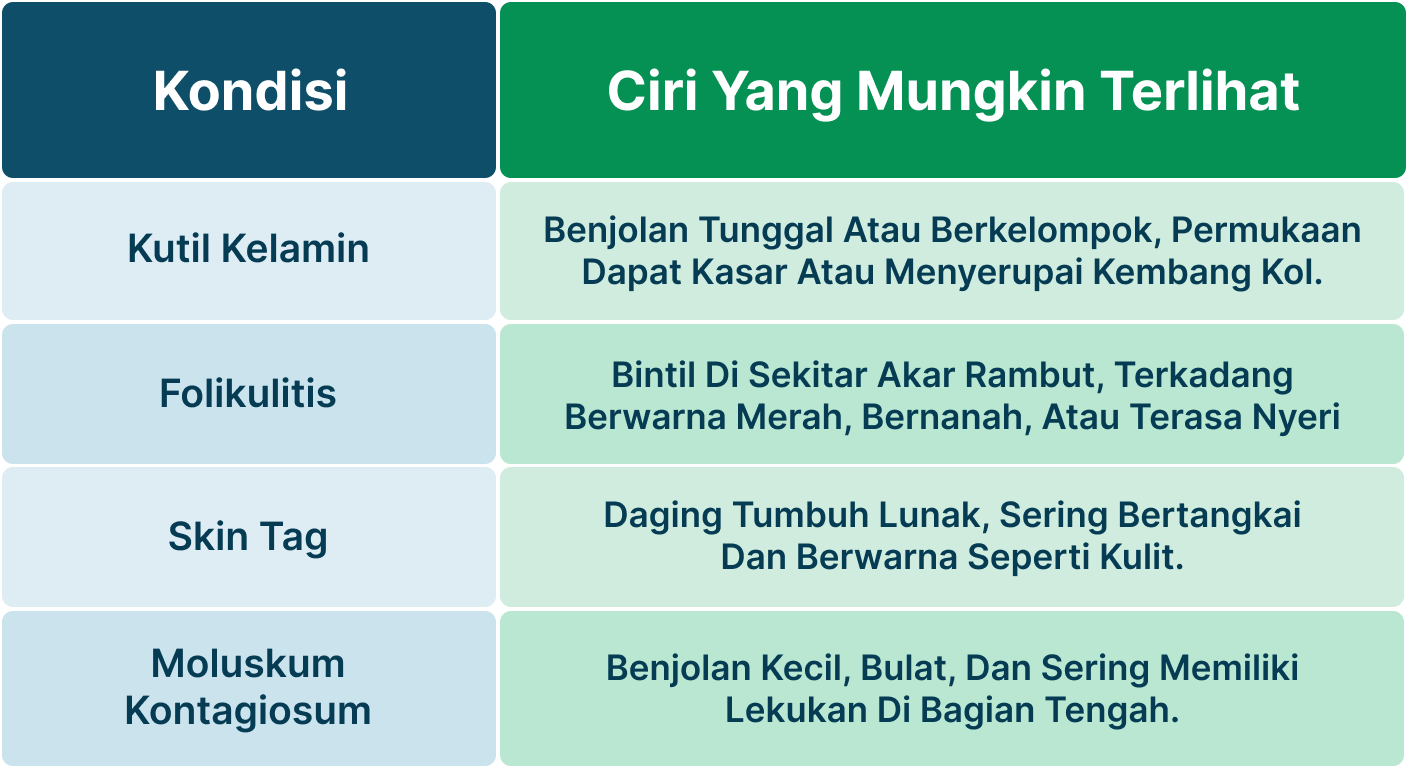 Ilustrasi Kutil Kelamin di Selangkangan.