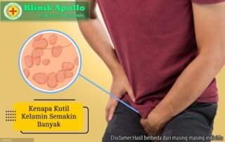 Ilustrasi Kenapa Kutil Kelamin Semakin Banyak.