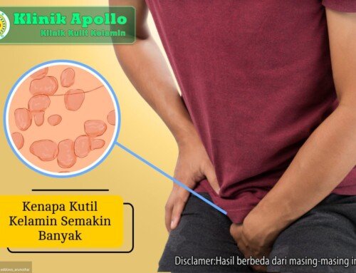 Alasan Kutil Kelamin Semakin Banyak dan Cara Mencegahnya