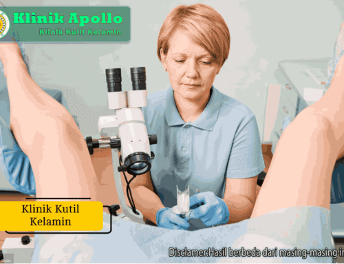 Klinik Kutil Kelamin untuk Konsultasi dan Pengobatan