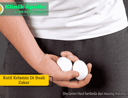 Kutil Kelamin di Buah Zakar: Penyebab dan Cara Mengobatinya