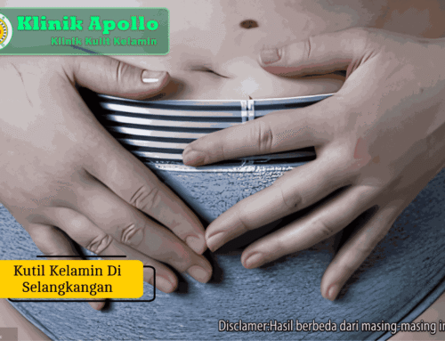 Kutil Kelamin di Selangkangan: Ciri dan Cara Mengobatinya