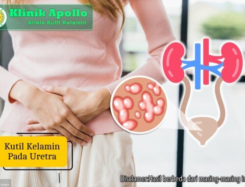 Kutil Kelamin pada Uretra, Apakah Berbahaya?