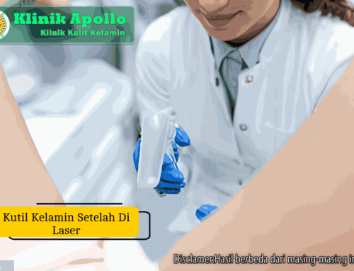 Kutil Kelamin Setelah di Laser: Normal atau Kambuh?