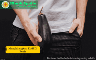 Ilustrasi Menghilangkan Kutil di Penis.
