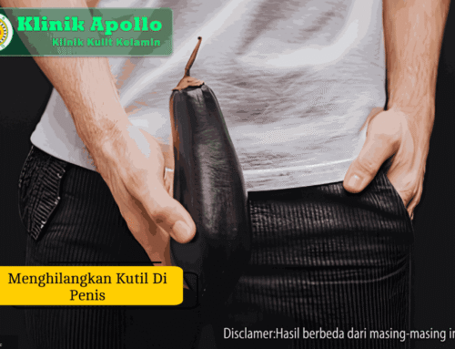 6 Cara Menghilangkan Kutil di Penis Sampai Tuntas