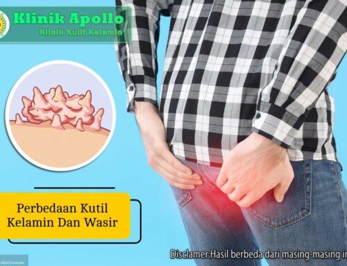 Kenali Perbedaan Kutil Kelamin dan Wasir, Jangan Keliru!